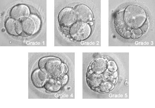 依胚葉大小和細胞碎片來區分胚胎級數